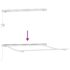 vidaXL Awning Manual White 3 x 2.5 m Metal - Image 9